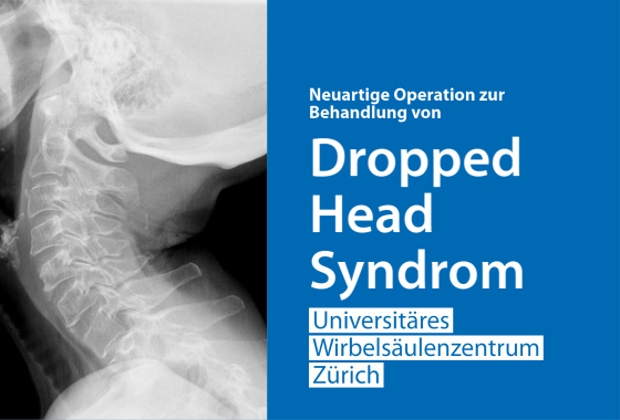 Operation «Dropped Head Syndrom» Röntgenbild des Halses einer Patientin mit dem Dropped Head Syndrom.