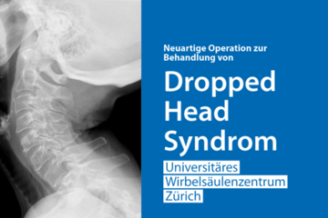Operation «Dropped Head Syndrom» Röntgenbild des Halses einer Patientin mit dem Dropped Head Syndrom.