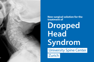 Surgery «Dropped Head Syndrom» Radiograph of the neck of a patient with Dropped head syndrome.