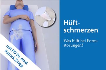 Was hilft bei Hüftschmerzen? Was hilft bei Hüftschmerzen?
