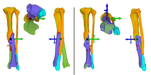 Dreidimensionale Analyse der Fehlstellung. Dreidimensionale Darstelung der Fehlstellung von vorne und von der Seite.