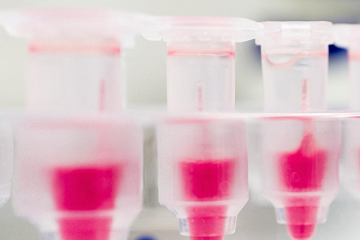 Forschung Sportmedizin Balgrist Forschung Sportmedizin