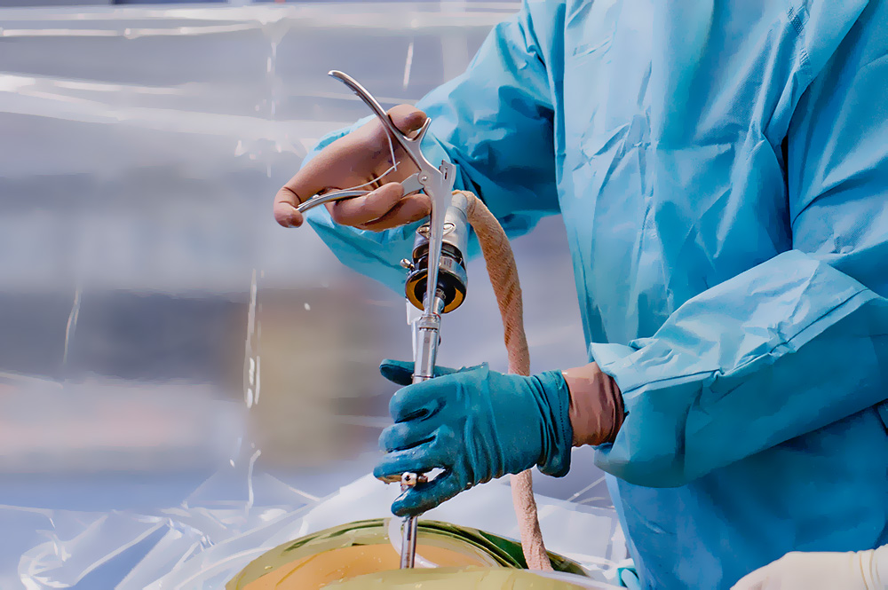 Endoskopische Wirbelsäulenchirurgie - weniger Schmerzen, schneller fit