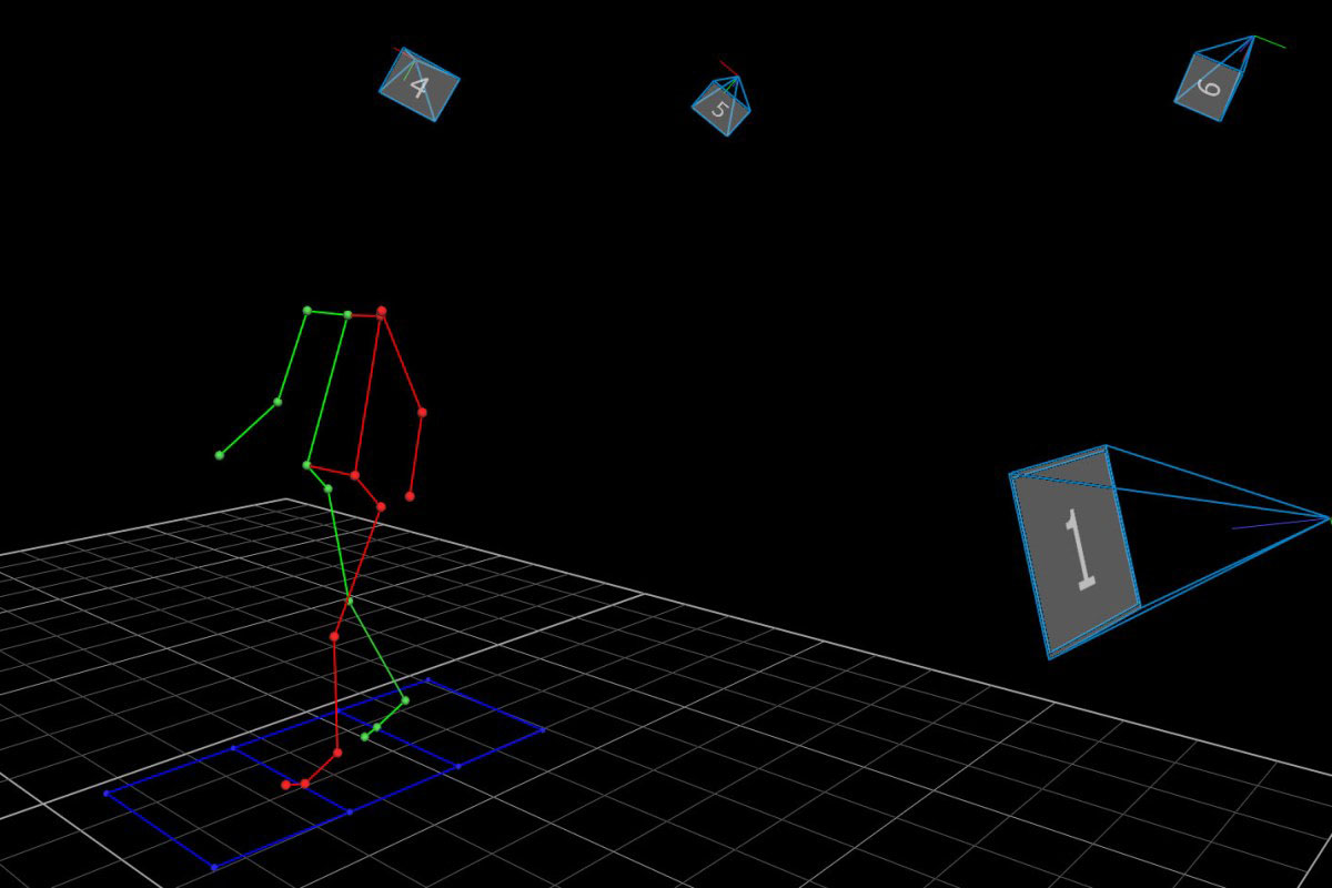 Ganglabor Balgrist Forschung Paraplegie Gehbeeinträchtigungen