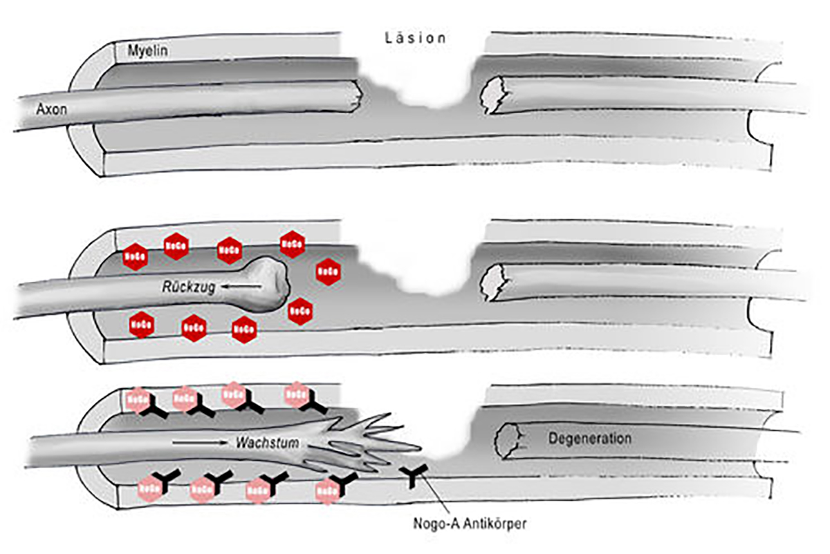 Nogo-Antikörper-Studie Balgrist Forschung Paraplegie Nervenregeneration Nervenfasern