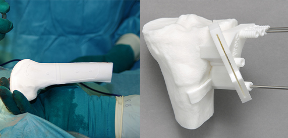 Patientenspezifische Navigationshilfe Patientenspezifische Navigationshilfe